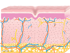 Collagen Remodeling Occurs | Skin Tightening & Cellulite Reduction
